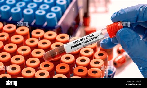 Laboratory Testing for Mycoplasma pneumoniae 